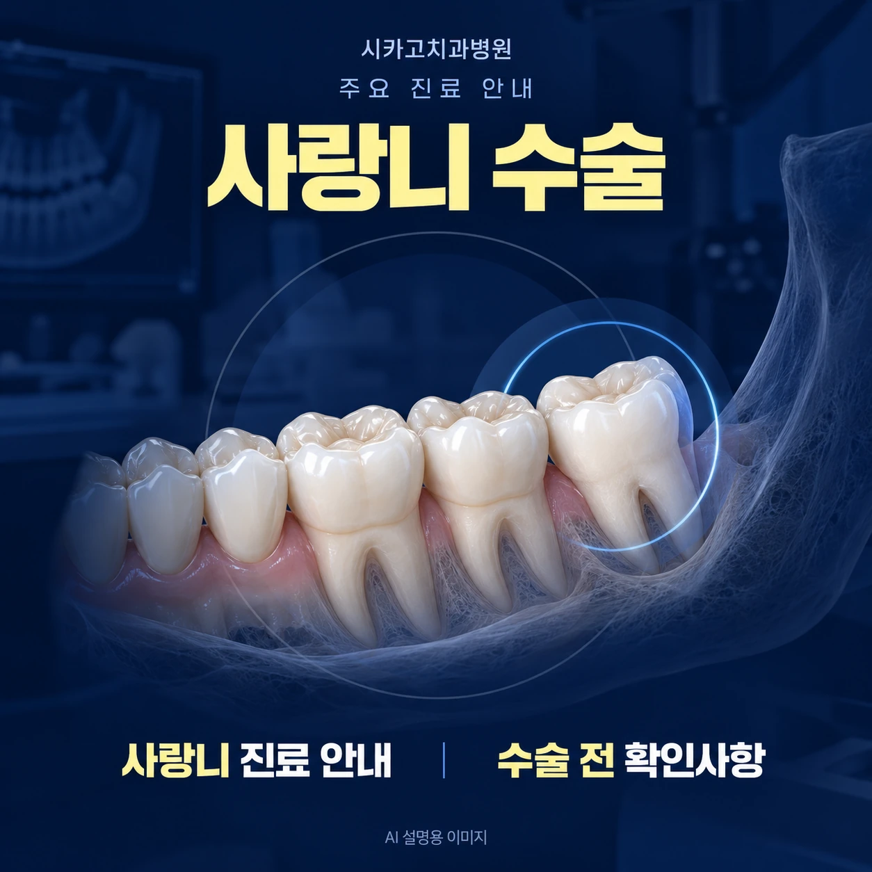 사랑니 수술 — AI 설명용 이미지이며 실제 환자·시술 사진이 아닙니다.